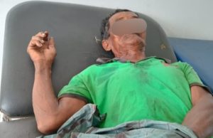 Heboh, Air Sugihan Digemparkan Oleh Gigitan Anjing Liar