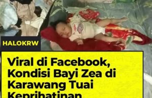 Kisah Bayi Zea di Karawang Viral, Hidup dalam Keterbatasan Bersama Nenek