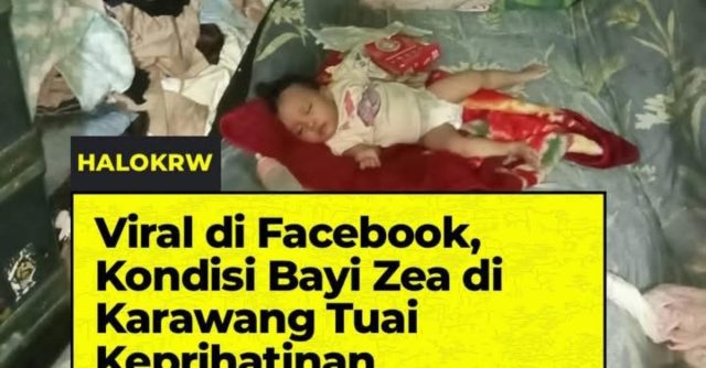 Kisah Bayi Zea di Karawang Viral, Hidup dalam Keterbatasan Bersama Nenek