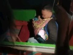 Seorang Anak di Mekar Sari Alami Patah Tulang Akibat Kecelakaan